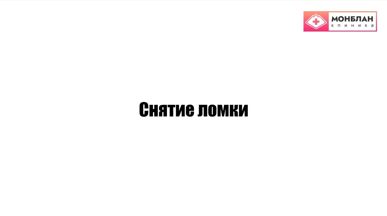 Видеоролик на тему: Снятие ломки